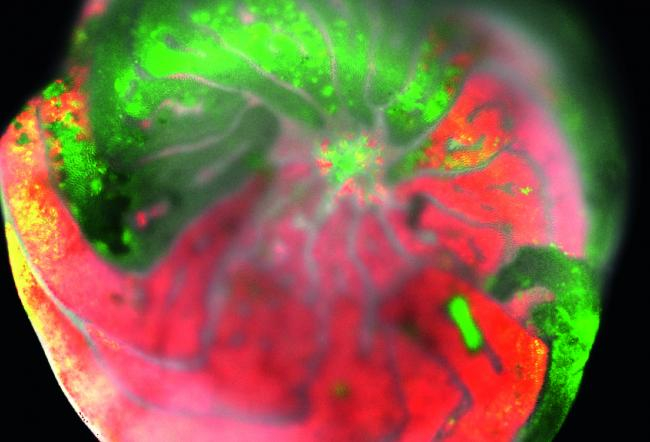 Eine teilweise gebleichte Foraminifere nach einem Monat Temperaturstress (32°C) - unter dem Fluoreszenzmikroskop. Rote Bereiche zeigen die Autofluoreszenz des Chlorophylls der symbiontischen Algen und grüne Bereiche zeigen Fluoreszenz organischen Materials in gebleichten Teilen ohne Symbionten. Foto: Erik Freier, Leibniz-Institut für Analytische Wissenschaften - ISAS - e.V.