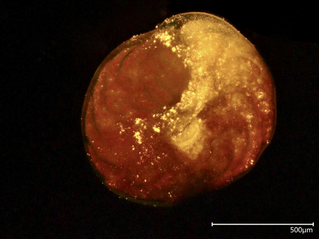 Die große Anzahl fluoreszierender gelber Punkte in dieser Foraminifere sind aufgenommene Nanoplastikteilchen. (Foto: Marlena Joppien, Leibniz-Zentrum für Marine Tropenforschung)